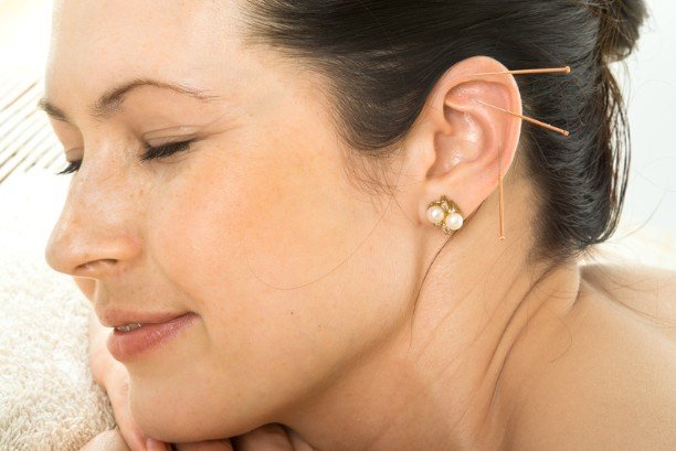 The Expanding Role of Acupuncture in Modern Multidisciplinary Care Models